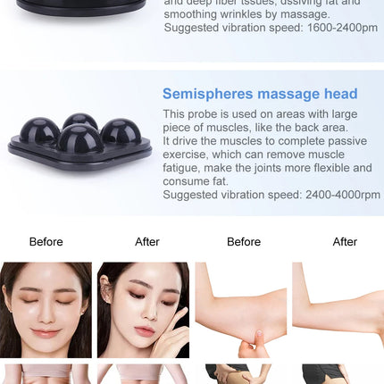 Masaje vibratorio G5, máquina de belleza para adelgazar, forma del cuerpo, pérdida de peso, cintura, relajación muscular, dispositivo anticelulítico de alta frecuencia