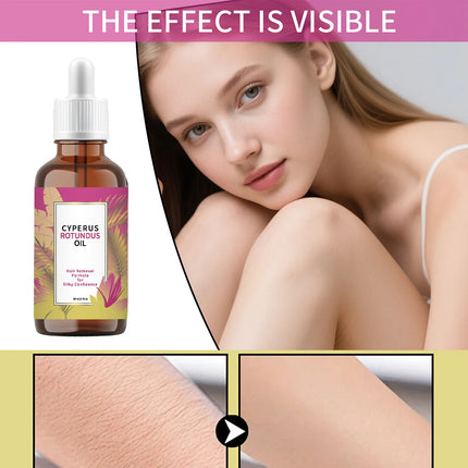 Aceite depilatorio hidratante Cyperus Rotundus: removedor de vello corporal, inhibidor de crecimiento, reduce el cabello encarnado para axila, pierna y brazo