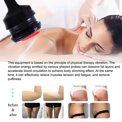 Masaje vibratorio G5, máquina de belleza para adelgazar, forma del cuerpo, pérdida de peso, cintura, relajación muscular, dispositivo anticelulítico de alta frecuencia