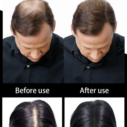 SEVICH fibra de cabello 100g queratina fibra de cabello en polvo espesante fibra de construcción de cabello Spray polvo de crecimiento instantáneo pérdida de cabello ocultar